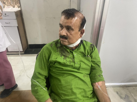 कांग्रेस सह–महामन्त्री यादवलाई खुकुरी हान्ने सापकोटा कारागार चलान
